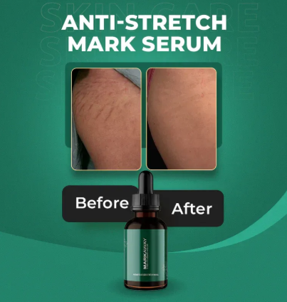 Markaway Stretch Mark Serum – Herbal Formula